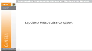 LEUCEMIA MIELOBLÁSTICA AGUDA
 