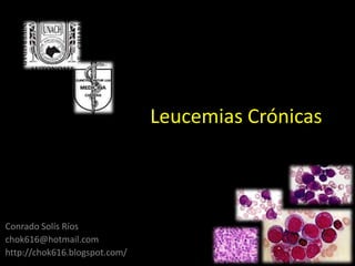 Leucemias Crónicas



Conrado Solís Ríos
chok616@hotmail.com
http://chok616.blogspot.com/
 