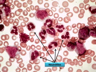 Neutrófilo   Mielocito




                   Neutrófilos
 