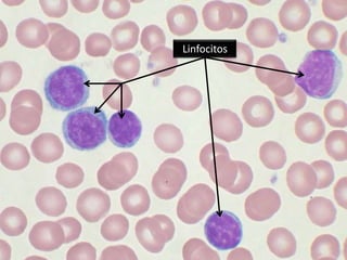 Linfocitos
 