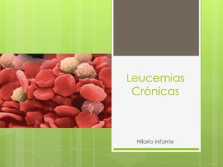 Leucemias
 Crónicas



 Hilario Infante
 