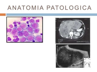 ANATOMIA PATOLOGICA 
 
