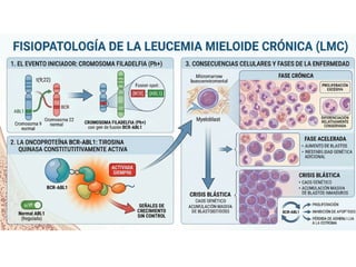Leukemia Types Overview Comprehensive Overview of Leukemias: Types, Diagnosis, and Treatment | PDF
