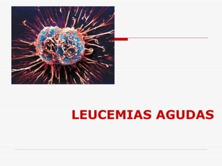 LEUCEMIAS AGUDAS
 