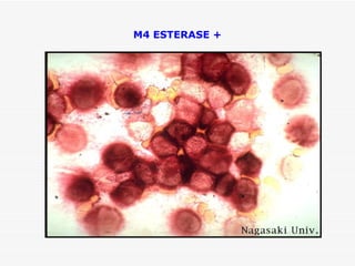 M4 ESTERASE +
 