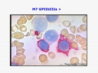M7 GPIIbIIIa +
 