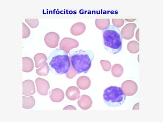 Linfócitos Granulares
 