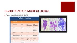 CLASIFICACION MORFOLOGICA
 French-American-British (FAB)
 