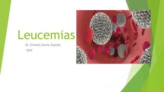 Leucemias
Dr. Ernesto Genie Zepeda
UCN
 