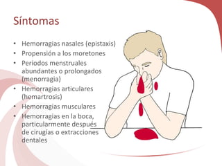 Síntomas
• Hemorragias nasales (epistaxis)
• Propensión a los moretones
• Periodos menstruales
abundantes o prolongados
(menorragia)
• Hemorragias articulares
(hemartrosis)
• Hemorragias musculares
• Hemorragias en la boca,
particularmente después
de cirugías o extracciones
dentales
 