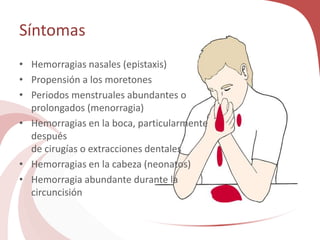 Síntomas
• Hemorragias nasales (epistaxis)
• Propensión a los moretones
• Periodos menstruales abundantes o
prolongados (menorragia)
• Hemorragias en la boca, particularmente
después
de cirugías o extracciones dentales
• Hemorragias en la cabeza (neonatos)
• Hemorragia abundante durante la
circuncisión
 