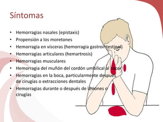 Síntomas
• Hemorragias nasales (epistaxis)
• Propensión a los moretones
• Hemorragia en vísceras (hemorragia gastrointestinal)
• Hemorragias articulares (hemartrosis)
• Hemorragias musculares
• Hemorragia del muñón del cordón umbilical al nacer
• Hemorragias en la boca, particularmente después
de cirugías o extracciones dentales
• Hemorragias durante o después de lesiones o
cirugías
 