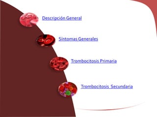 Descripción General
Síntomas Generales
Trombocitosis Primaria
Trombocitosis Secundaria
 