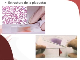 • Estructura de la plaqueta:
 