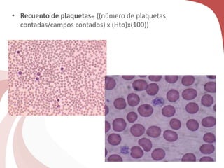 • Recuento de plaquetas= ((número de plaquetas
contadas/campos contados) x (Hto)x(100))
 