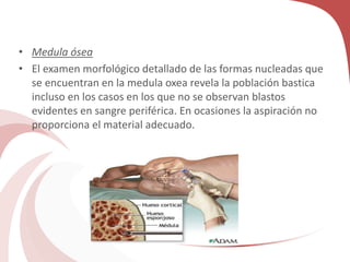 • Medula ósea
• El examen morfológico detallado de las formas nucleadas que
se encuentran en la medula oxea revela la población bastica
incluso en los casos en los que no se observan blastos
evidentes en sangre periférica. En ocasiones la aspiración no
proporciona el material adecuado.
 