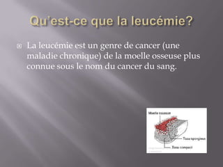 Qu’est-ce que la leucémie?La leucémie est un genre de cancer (une maladie chronique) de la moelle osseuse plus connue sous le nom du cancer du sang. 