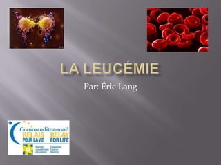 La leucémie Par: Éric Lang 