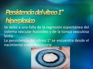 Se debe a una falla de la regresión espontanea del
sistema vascular hialoideo y de la túnica vasculosa
lentis
La persistencia del vítreo 1° se encuentra desde el
nacimiento como leucocoria
 