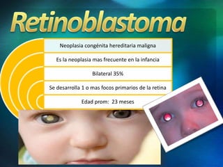 Neoplasia congénita hereditaria maligna
Es la neoplasia mas frecuente en la infancia
Bilateral 35%
Se desarrolla 1 o mas focos primarios de la retina
Edad prom: 23 meses
 