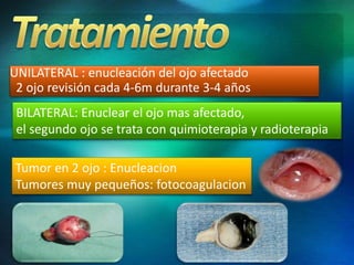 UNILATERAL : enucleación del ojo afectado
2 ojo revisión cada 4-6m durante 3-4 años
BILATERAL: Enuclear el ojo mas afectado,
el segundo ojo se trata con quimioterapia y radioterapia
Tumor en 2 ojo : Enucleacion
Tumores muy pequeños: fotocoagulacion
 