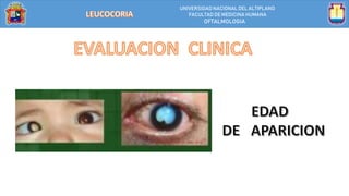 UNIVERSIDAD NACIONALDEL ALTIPLANO
FACULTAD DE MEDICINA HUMANA
OFTALMOLOGIA
 