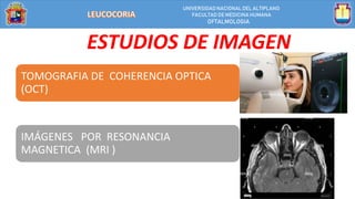 UNIVERSIDAD NACIONALDEL ALTIPLANO
FACULTAD DE MEDICINA HUMANA
OFTALMOLOGIA
ESTUDIOS DE IMAGEN
TOMOGRAFIA DE COHERENCIA OPTICA
(OCT)
IMÁGENES POR RESONANCIA
MAGNETICA (MRI )
 