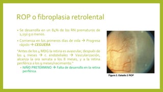 ROP o fibroplasia retrolental
• Se desarrolla en un 84% de los RN prematuros de
1,250 g o menos.
• Comienza en los primeros días de vida  Progresa
rápido  CEGUERA
“Antes de los 4 MDG la retina es avascular, después de
los 4 meses  c. endoteliales  Vascularización,
alcanza la ora serrata a los 8 meses, y a la retina
periférica a los 9 meses/nacimiento.”
• NIÑO PRETERMINO  Falta de desarrollo en la retina
periférica.
 