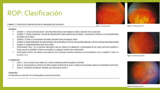 ROP: Clasificación
 