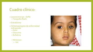 Cuadro clínico:
• Leucocoria (50 – 60%)
• Fotografía (flash)
• Estrabismo
• Síntomas/signos de enfermedad
extraocular
• Dolor
• Glaucoma
• Buftalmia
• Metástasis
• SNC
 