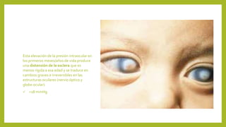 Esta elevación de la presión intraocular en
los primeros meses/años de vida produce
una distensión de la esclera que es
menos rígida a esa edad y se traduce en
cambios graves e irreversibles en las
estructuras oculares (nervio óptico y
globo ocular).
 >18 mmHg
 