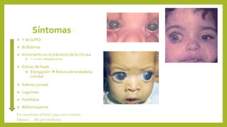 Síntomas
 ↑ de la PIO
 Buftalmos
 Incremento en el diámetro de la córnea
 > 12 mm = Megalocornea
 Estrias de Haab
 Elongación  Rotura del endoltelio
corneal
 Edema corneal
 Lagrimeo
 Fotofobia
 Blefarospasmo
En ocasiones el bebé nace con corneas
blancas… Dx por pediatra.
 