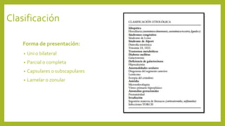 Clasificación
Forma de presentación:
• Uni o bilateral
• Parcial o completa
• Capsulares o subscapulares
• Lamelar o zonular
 