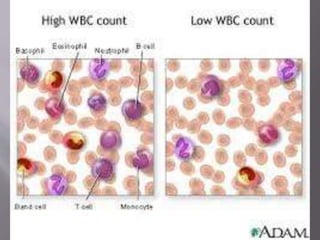 Leucocyte disorders