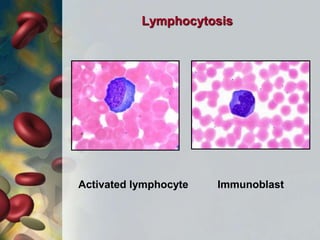 Activated lymphocyte
Lymphocytosis
Immunoblast
 