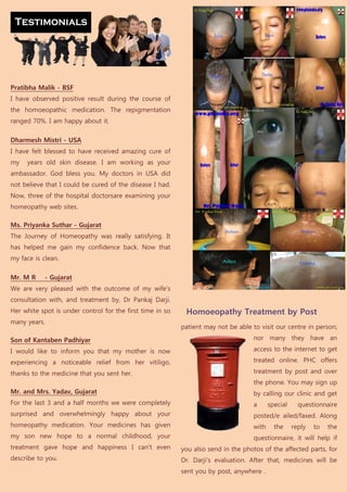 Pratibha Malik - BSF
I have observed positive result during the course of
the homoeopathic medication. The repigmentation
ranged 70%. I am happy about it.

Dharmesh Mistri - USA
I have felt blessed to have received amazing cure of
my   years old skin disease. I am working as your
ambassador. God bless you. My doctors in USA did
not believe that I could be cured of the disease I had.
Now, three of the hospital doctorsare examining your
homeopathy web sites.

Ms. Priyanka Suthar - Gujarat
The Journey of Homeopathy was really satisfying. It
has helped me gain my confidence back. Now that
my face is clean.

Mr. M R     - Gujarat
We are very pleased with the outcome of my wife's
consultation with, and treatment by, Dr Pankaj Darji.
Her white spot is under control for the first time in so    Homoeopathy Treatment by Post
many years.
                                                           patient may not be able to visit our centre in person;

Son of Kantaben Padhiyar                                                            nor many they have an

I would like to inform you that my mother is now                                    access to the internet to get

experiencing a noticeable relief from her vitiligo,                                 treated online. PHC offers

thanks to the medicine that you sent her.                                           treatment by post and over
                                                                                    the phone. You may sign up
Mr. and Mrs. Yadav, Gujarat                                                         by calling our clinic and get
For the last 3 and a half months we were completely                                 a      special     questionnaire
surprised and overwhelmingly happy about your                                       posted/e ailed/faxed. Along
homeopathy medication. Your medicines has given                                     with     the     reply   to   the
my son new hope to a normal childhood, your                                         questionnaire, it will help if
treatment gave hope and happiness I can't even             you also send in the photos of the affected parts, for
describe to you.                                           Dr. Darji’s evaluation. After that, medicines will be
                                                           sent you by post, anywhere .
 