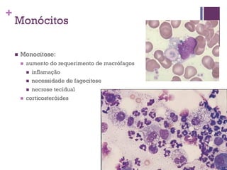 +
    Monócitos

       Monocitose:
           aumento do requerimento de macrófagos
               inflamação
               necessidade de fagocitose
               necrose tecidual
           corticosteróides
 