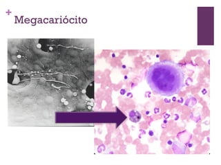 +
    Megacariócito
 