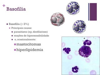 +
    Basofilia

       Basofilia ( 2%)
           Principais causas:
               parasitismo (eg, dirofilariose)
               reações de hipersensibilidade
               e, ocasionalmente:

                 mastocitomas
                 hiperlipidemia
 