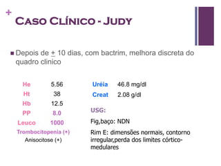 +
    Caso Clínico - Judy

 Depois   de + 10 dias, com bactrim, melhora discreta do
    quadro clinico


      He        5.56      Uréia    46.8 mg/dl
      Ht         38       Creat    2.08 g/dl
      Hb        12.5
      PP        8.0       USG:

    Leuco      1000       Fig,baço: NDN
    Trombocitopenia (+)   Rim E: dimensões normais, contorno
       Anisocitose (+)    irregular,perda dos limites córtico-
                          medulares
 