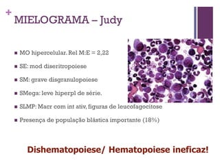 +
    MIELOGRAMA – Judy

       MO hipercelular. Rel M:E = 2,22

       SE: mod diseritropoiese

       SM: grave disgranulopoiese

       SMega: leve hiperpl de série.

       SLMP: Macr com int ativ, figuras de leucofagocitose

       Presença de população blástica importante (18%)




          Dishematopoiese/ Hematopoiese ineficaz!
 