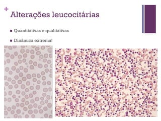 +
    Alterações leucocitárias
       Quantitativas e qualitativas

       Dinâmica extrema!
 