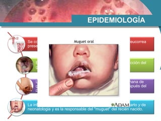 EPIDEMIOLOGÍA
Se considera que más del 50% de las embarazadas con leucorrea
presentan moniliasis en la secreción vaginal.
El embarazo aumenta la frecuencia de candidiasis (acción del
glucógeno).
La enfermedad se manifiesta después de la 20a. semana de
gestación y suele desaparecer espontáneamente después del
parto.
La infección materna puede propagarse en las salas de parto y de
neonatologia y es la responsable del "muguet" del recién nacido.
 