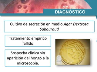 DIAGNÓSTICO
Cultivo de secreción en medio Agar Dextrosa
Sabouraud
Tratamiento empírico
fallido
Sospecha clínica sin
aparición del hongo a la
microscopia.
 