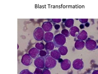 Blast Transformation
 