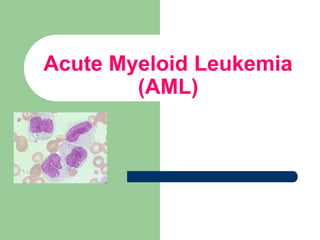 Acute Myeloid Leukemia
(AML)
 