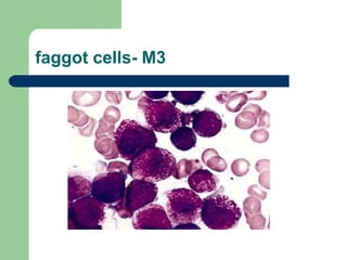 faggot cells- M3
 