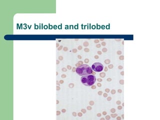 M3v bilobed and trilobed
 