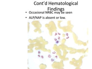 Cont’d Hematological
Findings
• Occasional NRBC may be seen
• ALP/NAP is absent or low.
 