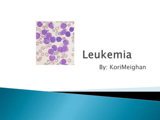 Leukemia	 By: KoriMeighan 